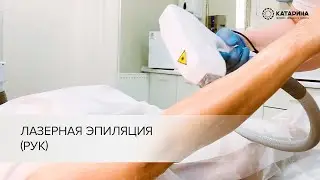 Лазерная эпиляция (рук)