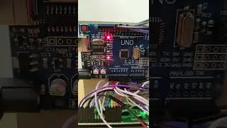 Ultrasonic meter #shorts #short #electronics_project #arduino #asmr #viral