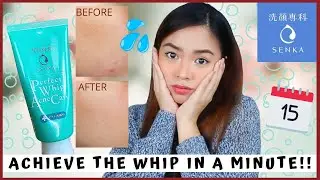 I TRIED SENKA PERFECT WHIP ACNE CARE FOR 14 DAYS! | Quarantine Diaries