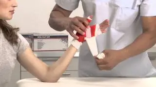 Delta-Cast Soft Removeable Thumb Spica Cast Application
