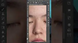 Remove Acne and pimples in Photoshop 💻#photoshoptutorial #shorts