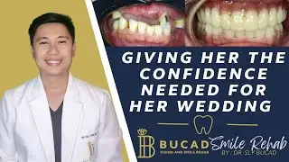 Giving Her the Confidence Needed for Her Wedding