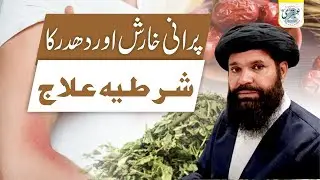 Purani Kharish Aur Dhadar Ka Shartia Ilaj | kharish ka ilaj