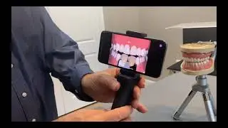 Shade Arm Dental Photography