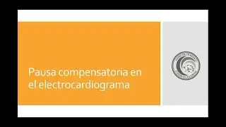 Pausa compensatoria en el electrocardiograma