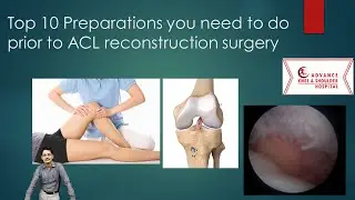 Top 10 Preparation for ACL Reconstuction surgery