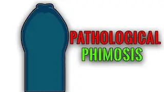 What is Pathological Phimosis