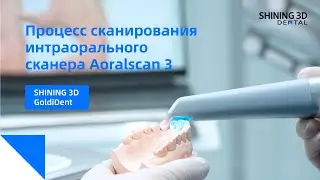 Процесс сканирования интраорального сканера Aoralscan 3 Shining 3D | репост GoldiDent