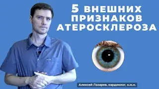 5 ВНЕШНИХ ПРИЗНАКОВ АТЕРОСКЛЕРОЗА 