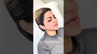 Coolaser® Skin Resurfacing