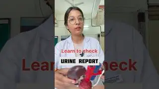 Learn to check URINE REPORT in 1 min #doctor #medicine #neetpg #neet