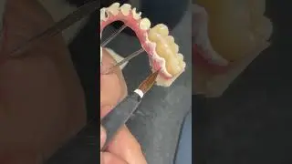 Full mouth art!