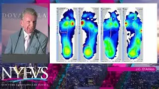 Biomechanics of the Neuropathic Foot   Joseph C  D’Amico