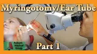 Myringotomy & Ear Tube Part 1 Feat. Dr. Tim Fife : Myringotomy | Auburn Medical Group