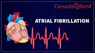 Atrial Fibrillation (AFib): Causes, ECG Findings, Treatment & Stroke Risk | Cardiology | CanadaQBank
