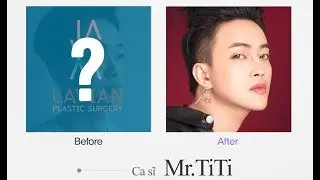 NAM CA SĨ TITI NHÓM NHẠC HKT ĐÃ PHẪU THUẬT THẨM MỸ GÌ? | Bệnh viện thẩm mỹ LAVIAN