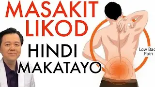 Masakit ang Likod: Hindi Makatayo  - Payo ni Doc Willie Ong 