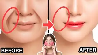 5MINS SMILE LINES Facial Exercises (Nasolabial Folds/ Laugh Lines) | Lift Jowls, Sagging Cheeks