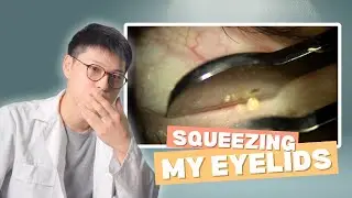 Squeezing my eyelids was SATISFYING