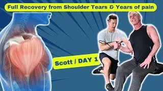 Full Recovery from Shoulder Tears & Years of Pain - Scott  Day 1/3