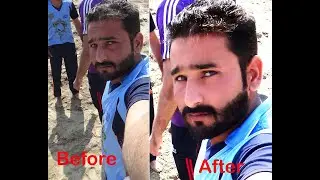 Photo Editing / Retouching / Pimple and Dark Circle Removing in adobe Photoshop 7.0