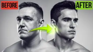 How to Get a Chiseled Jawline Fast with Simple Exercises