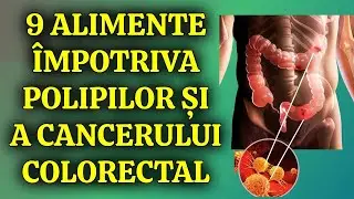 9 Alimente Miraculoase Pentru a Elimina Polipii din Colon și a Opri Cancerul Intestinal