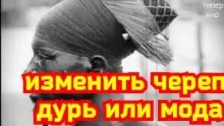 Зачем деформировали череп
