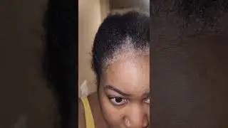 😭 Major natural hair set back | Alopecia? | DONT order Amazon crochet Hair Unless you ACV it first