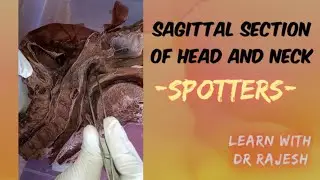 sagittal section of head and neck (spotters)- specimen demo