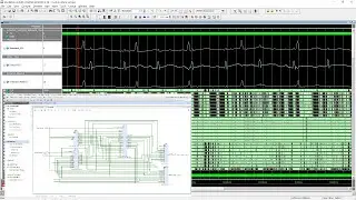 Extraction of Fetal ECG from Abdominal and Thorax ECG Using a Non-Causal Adaptive Filter