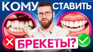 Всегда ли нужно лечить неправильный прикус? Признаки проблем с прикусом