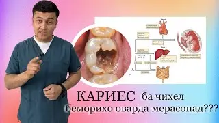 Кариес ба чикасалихо оварда расонданаш мумкин