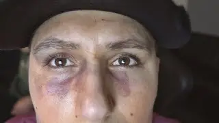 Versuchte Vergewaltigung & warum ich Geschlagen wurde...| Heracay