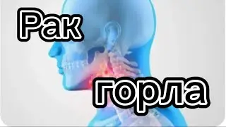 87052501890 #Невероятно!После 30 #облучений.Врачи в шоке!
