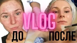 VLOG // Как я вылечила кожу // Уход // Как продвигается стройка дома // Семейные выходные