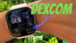 Dexcom To Fitbit Watch Tutorial - Including How To Set Up The Watch