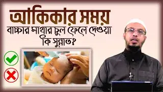 আকিকার সময় শিশুর মাথার চুল ফেলে দেওয়া কি সুন্নত? শায়খ আহমাদুল্লাহ।
