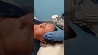 Восстановление кожи лица при помощи системы Квантовый Туман