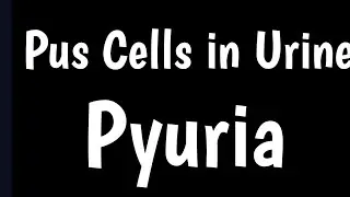 Pus Cells in Urine | What Is Pus Cell & Pyuria | Causes, Symptoms, Normal Range  Pus Cells In Urine