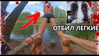ШКОЛЬНИК ОТБИЛ СЕБЕ ЛЕГКИЕ ПРЫГАЯ С ТАРЗАНКИ