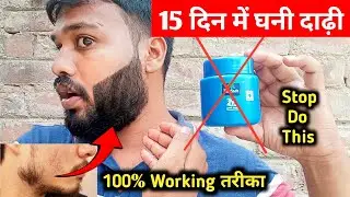 Patchy Beard Growth In 15 Days || Patchy Beard Solution || Dadhi Ghana Kaise Kare || Beard Oil