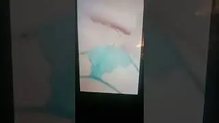 Live hot