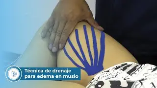 Técnica de drenaje para edema en muslo