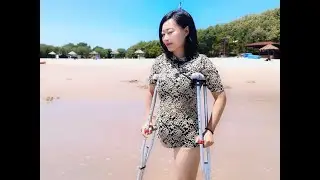 Emma: Shd Amputee lady on the beach