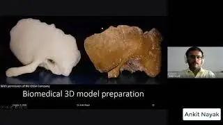 Data Preparation (Volumetric Mesh) for Finite Element Analysis of Human Body Parts