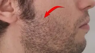 Close the holes in your beard (explained by a doctor)