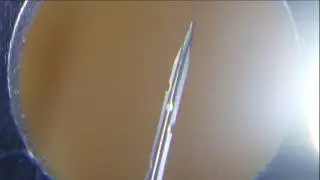 Punch Needles under the Microscope