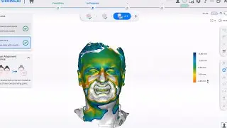 Metismile Facial Scanner and AoralScan 3 Wireless Integration