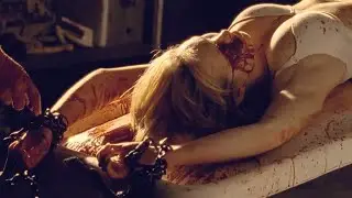 Rabid Movie Explained In Hindi | Movie Explorer Hindi